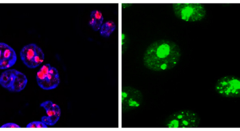 Lung cancer biomarkers Antibody Panel