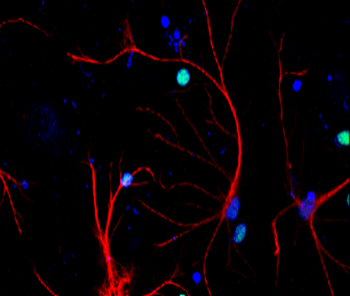 Traumatic Brain Injury (TBI) Biomarker Antibody Panel
