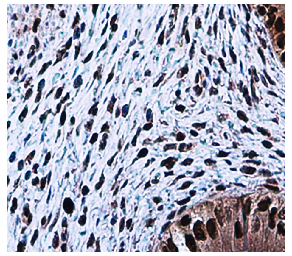PCNA, monoclonal antibody