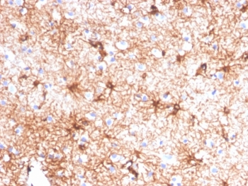 GFAP Antibody / Glial Fibrillary Acidic Protein