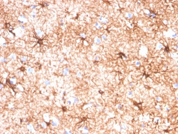 GFAP Antibody / Glial Fibrillary Acidic Protein