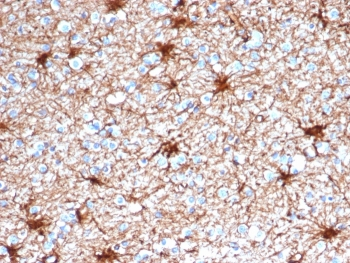GFAP Antibody / Glial Fibrillary Acidic Protein
