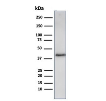 Recombinant Filaggrin Antibody