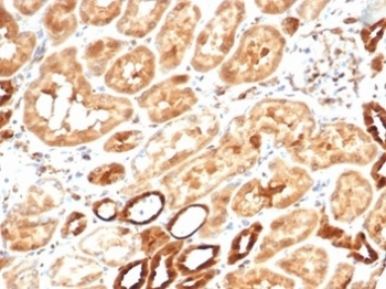 AKR1B1 Antibody / Aldose reductase