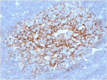 CD23 Antibody