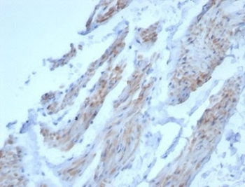 Desmin Antibody
