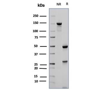 CD23 Antibody