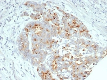 CFTR Antibody / Cystic Fibrosis Transmembrane Regulator