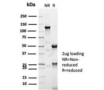 CFTR Antibody / Cystic Fibrosis Transmembrane Regulator