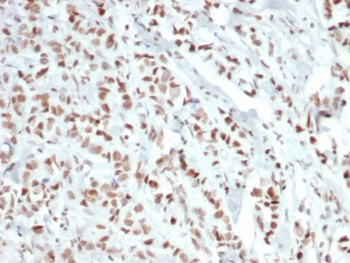 Recombinant Estrogen Receptor alpha Antibody