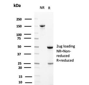 Clusterin Antibody / Apolipoprotein J / APO-J