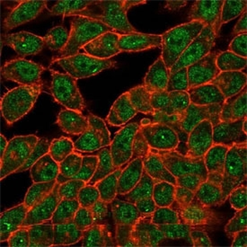 CELF2 Antibody / CUGBP2 / ETR3