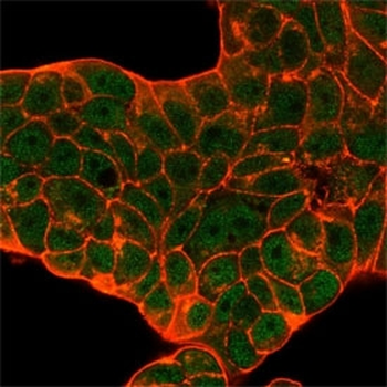 CELF2 Antibody / CUGBP2 / ETR3