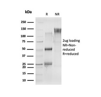 CELF2 Antibody / CUGBP2 / ETR3