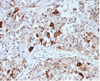 Prolactin Antibody / PRL