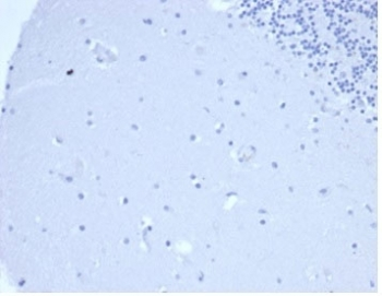 Prolactin Antibody / PRL