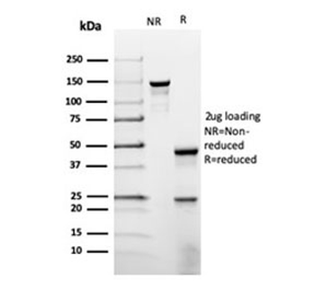 Prolactin Antibody / PRL