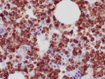 MPO Antibody / Myeloperoxidase