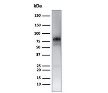 MPO Antibody / Myeloperoxidase