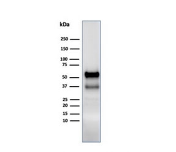 MPO Antibody / Myeloperoxidase