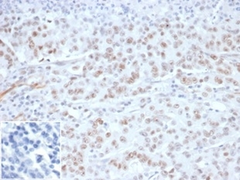 MLH1 Antibody / MutL Homolog 1