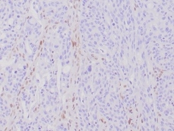 MLH1 Antibody / MutL Homolog 1