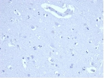 Ki-67 Antibody