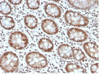 MSH6 Antibody