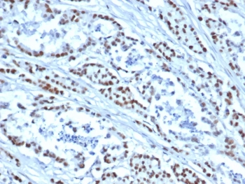 MSH6 Antibody