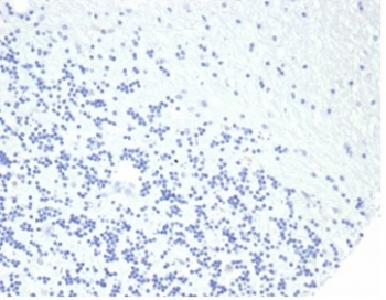 Growth Hormone Antibody / GH1