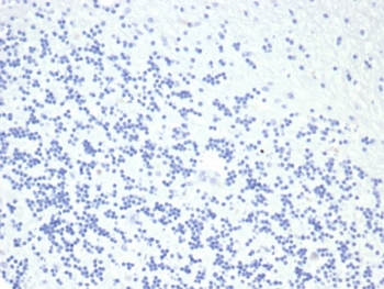 Growth Hormone Antibody / GH1
