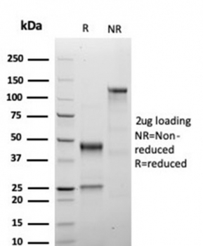 Growth Hormone Antibody / GH1
