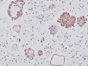 ALK Antibody / Anaplastic Lymphoma Kinase