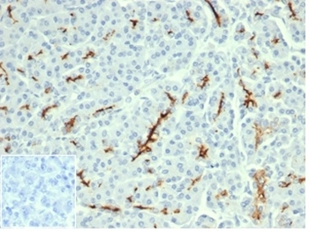 CFTR Antibody / Cystic Fibrosis Transmembrane Regulator