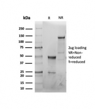 CFTR Antibody / Cystic Fibrosis Transmembrane Regulator