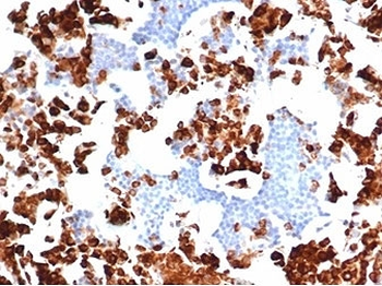 MPO Antibody / Myeloperoxidase