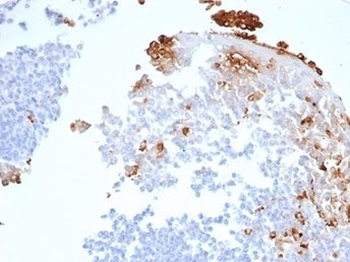 MPO Antibody / Myeloperoxidase
