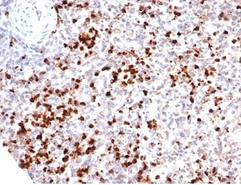 MPO Antibody / Myeloperoxidase