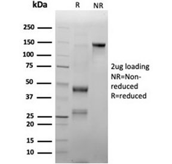 MPO Antibody / Myeloperoxidase