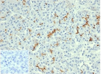 CFTR Antibody / Cystic Fibrosis Transmembrane Regulator