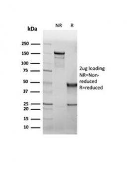 CFTR Antibody / Cystic Fibrosis Transmembrane Regulator