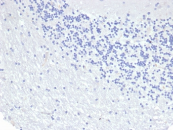 KRT8 Antibody / Cytokeratin 8