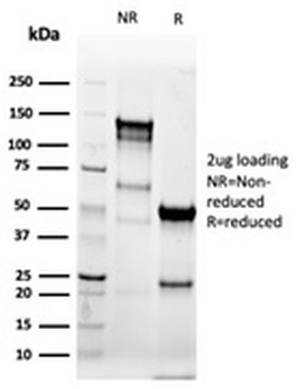 KRT8 Antibody / Cytokeratin 8