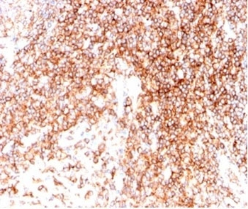 CD48 Antibody (Pan Leukocyte Marker)