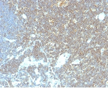 CD48 Antibody (Pan Leukocyte Marker)