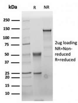 CEA Antibody / Carcinoembryonic Antigen