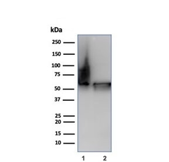 HSP60 Antibody