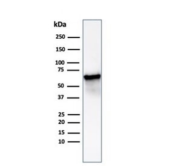 HSP60 Antibody