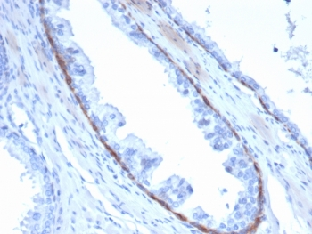 Cytokeratin 14 Antibody / CK14 / KRT14