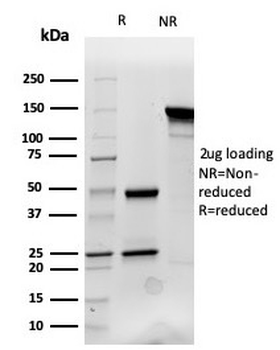 Cytokeratin 14 Antibody / CK14 / KRT14